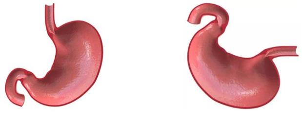 肠道气体代谢的核心是氢气，过经验分享篇