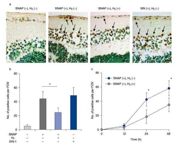 氢气改善青光眼的研究，一起看看效果如何呢？
