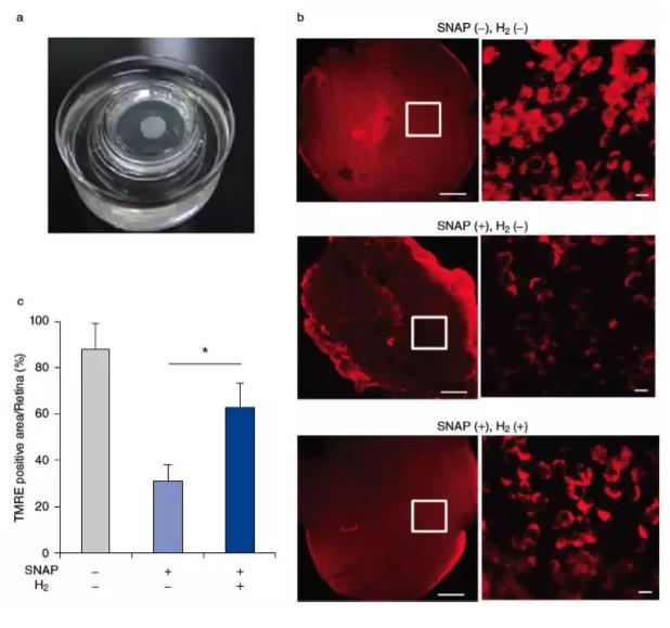 氢气改善青光眼的研究，一起看看效果如何呢？