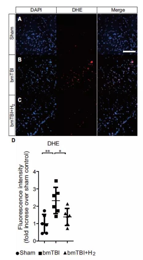 对脑爆伤，氢气也能担当！