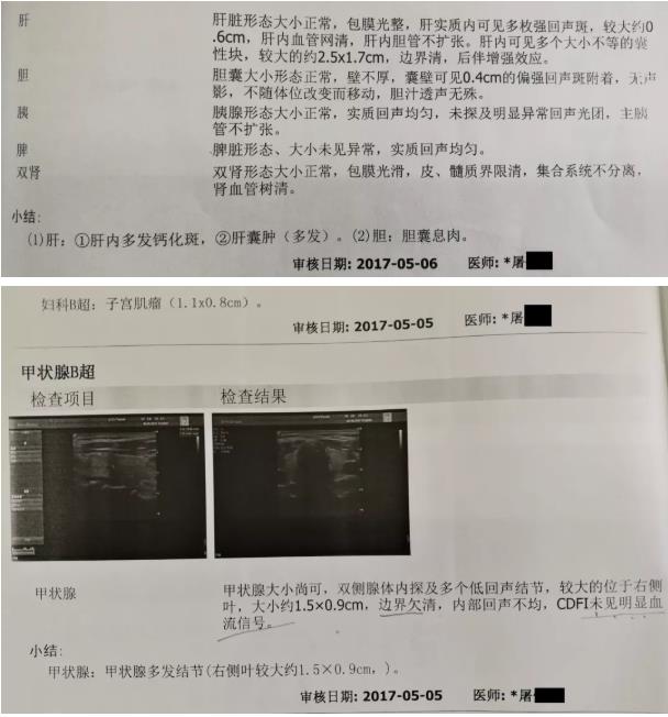 囊肿、息肉、结节，喝氢水都有效果