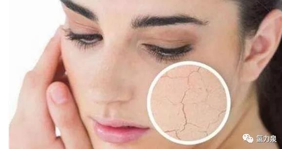 博天堂在线水改善脱发，白发也变少了！