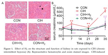 鼾声伤肾，吸氢固本！
