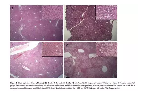 氢水改善脂肪肝，氢量代表剂量，剂量决定效果！（以色列）