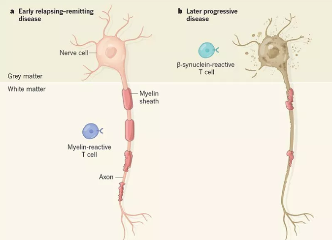 从髓鞘坏到神经元死的多发性硬化，氢气能旁观？
