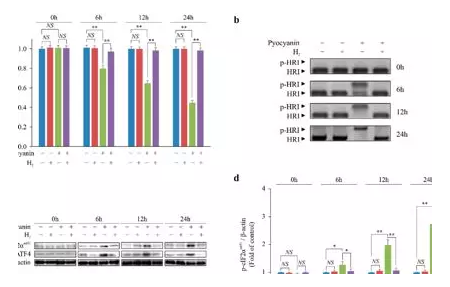 血红素是靶向药物，氢气能保护血红素