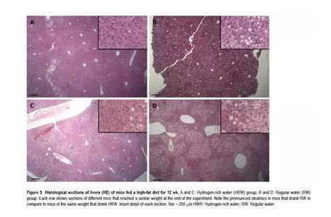氢水治疗脂肪肝，氢量代表剂量，剂量决定效果！（以色列）