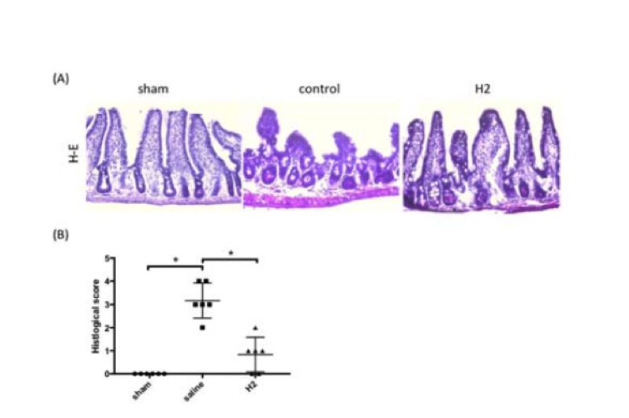 肠菌移位严重，氢气对抗轻松