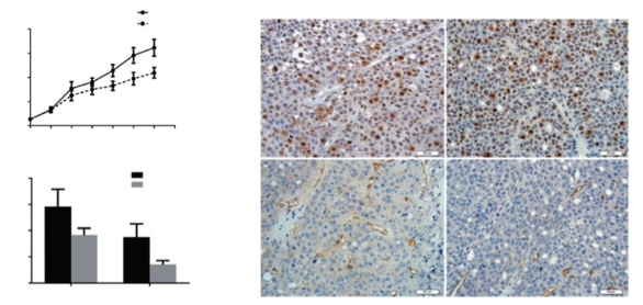 改善卵巢癌不靠运气靠氢气，拥抱氢气，给你健康！