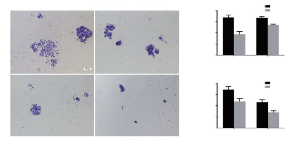 改善卵巢癌不靠运气靠氢气，拥抱氢气，给你健康！