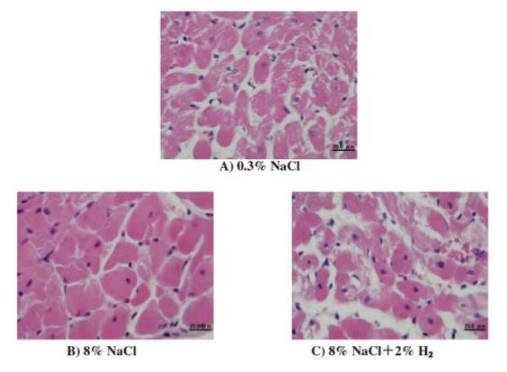 氢气对高血压有没有效果?氢气能改善高血压吗？
