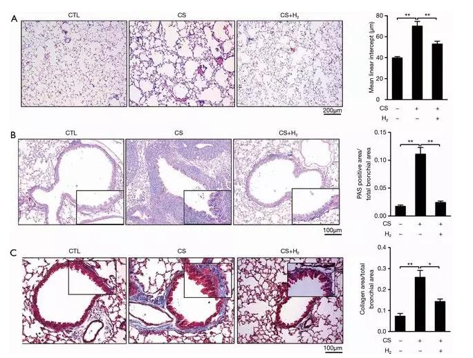 呼吸病教授：氢气改善慢阻肺