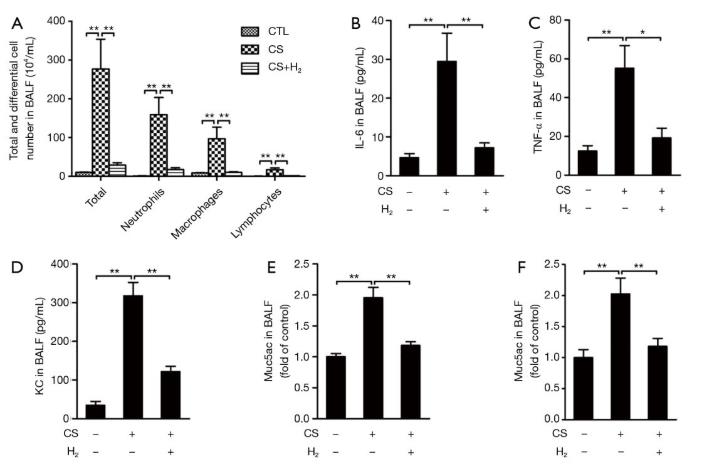 呼吸病教授：氢气改善慢阻肺