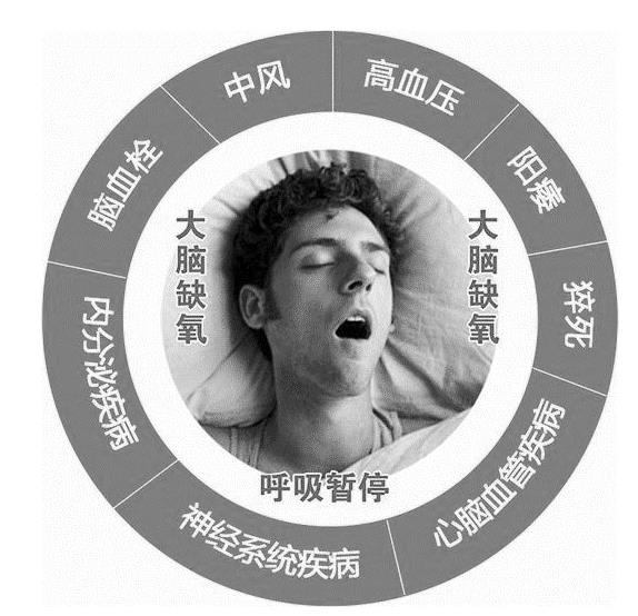 打呼噜是。】梢杂们馄纳瓶纯