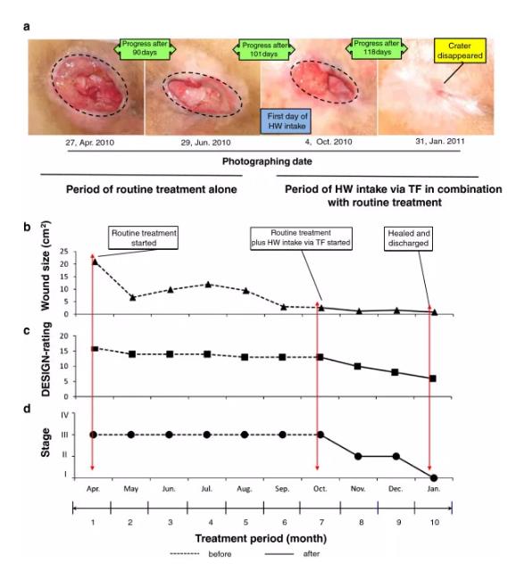 氢气改善的神奇之处，关键是效果很强