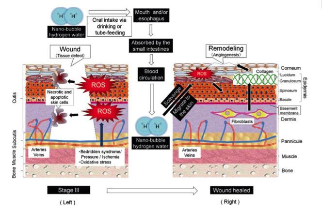 氢气改善的神奇之处，关键是效果很强