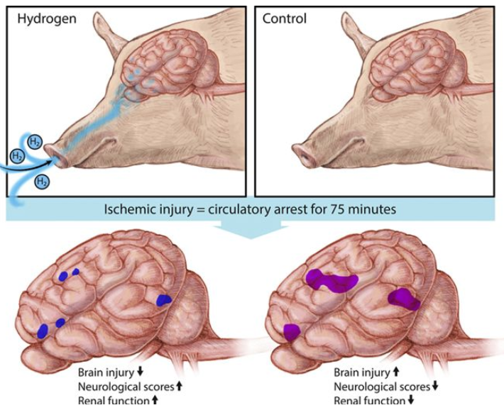 哈佛：氢气保护新生儿大脑
