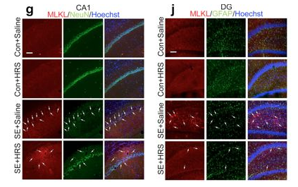 氢气能改善羊癫风？效果如何呢？