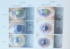 “氢”眼所见：氢分子与眼部疾病