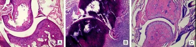 病理结果，A正常，B关节炎，C氢水治疗后
