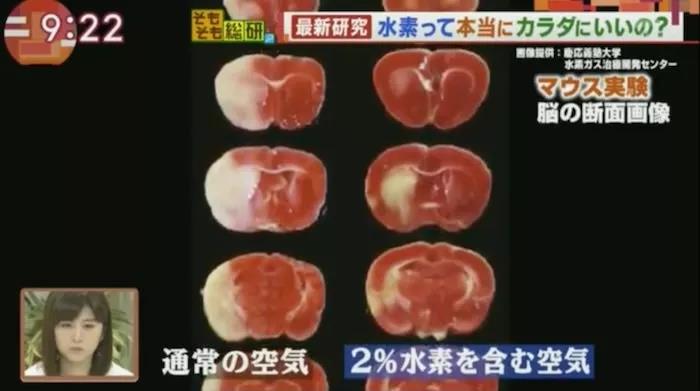 吸入氢气的小老鼠，脑梗塞部分减少约一半