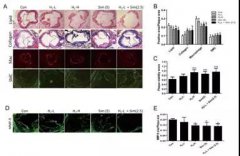 动脉斑块是健康的隐形炸弹，博天堂在线水为您氢除隐患