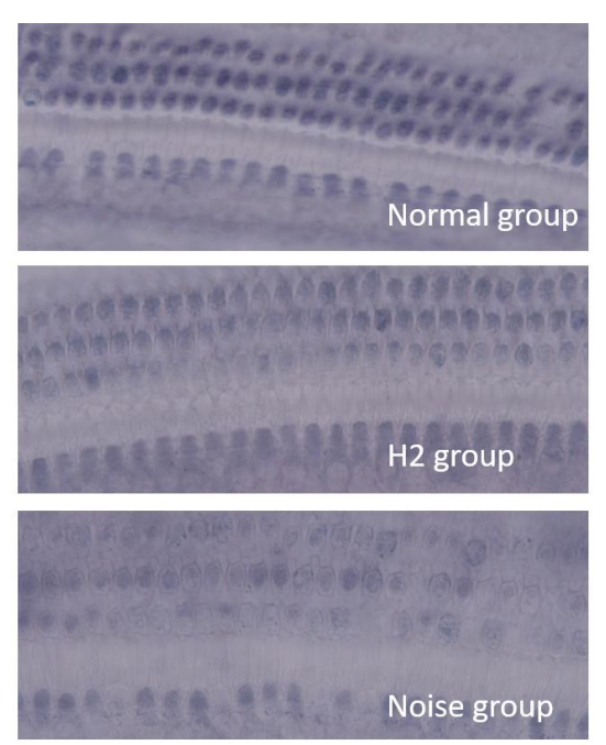 【氢医学·论文】氢气对噪声性聋的防护机制研究(图6)