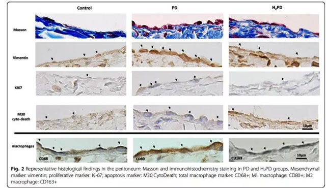 说明氢气透析液能对抗透析造成的腹膜损伤。